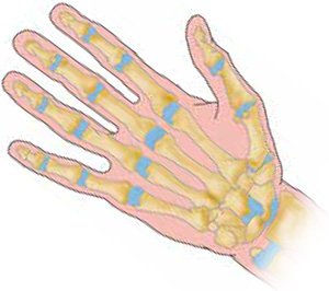 Bild zeigt die Knochen einer Hand